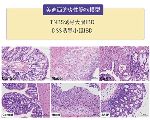 z6尊龙的炎症性肠病模型