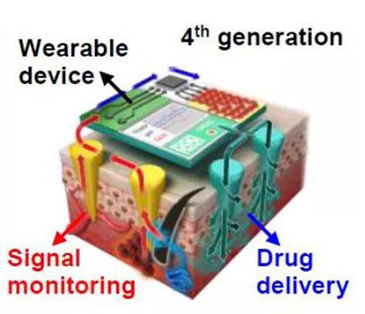 第四代透皮给药技术：在可穿戴设备的帮助下，用于患者定制治疗.jpg