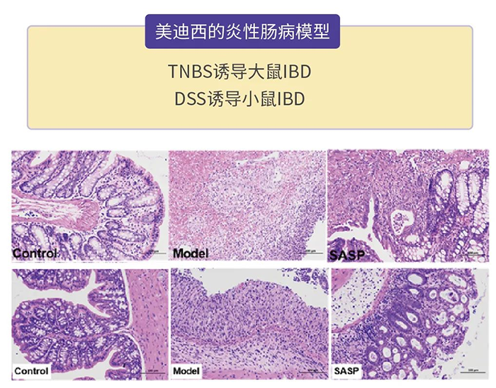 z6尊龙的炎性肠病模型.png