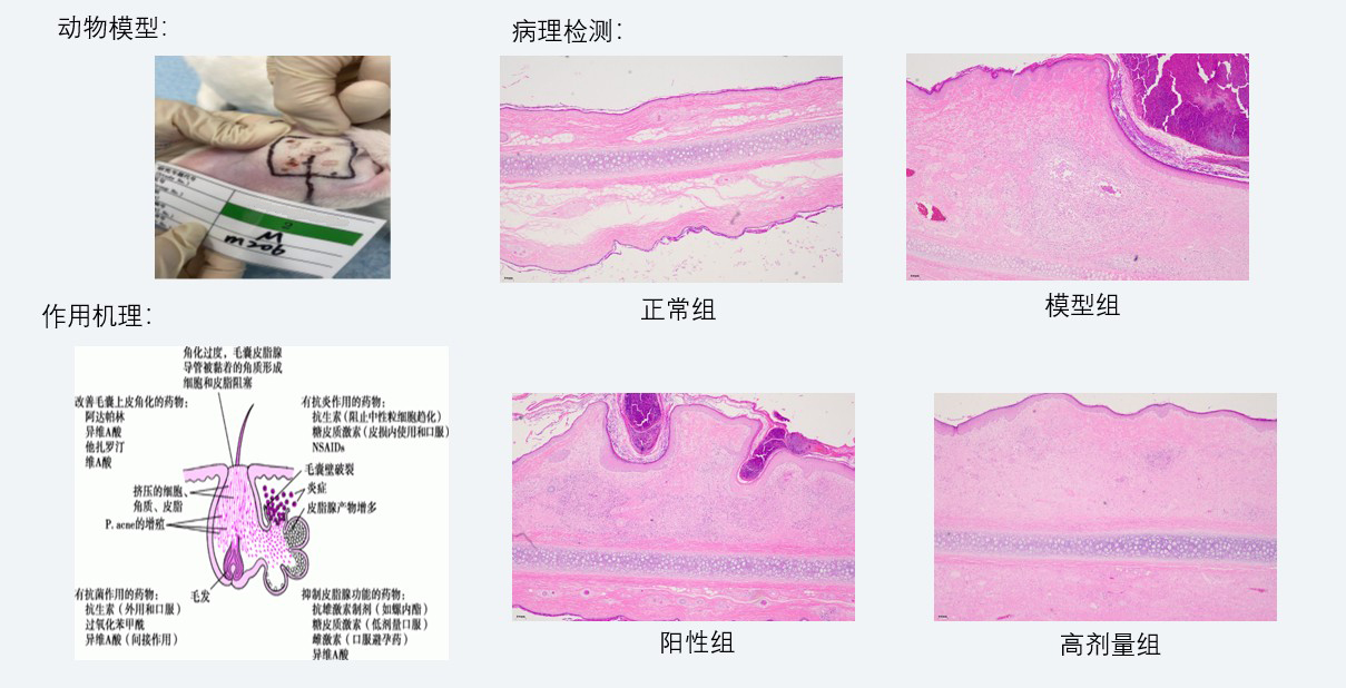 案例3：新西兰兔痤疮药效研究.jpg